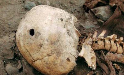 ​秘鲁考古惊现伟大头骨 科学家以为是外星人骨骼