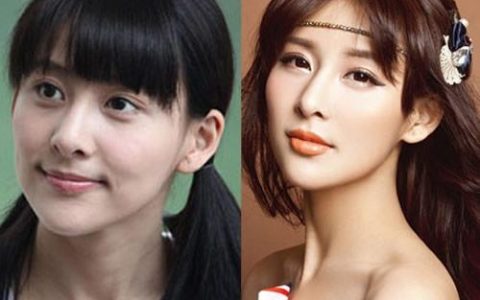 贾青整容前后(贾青没整容之前)