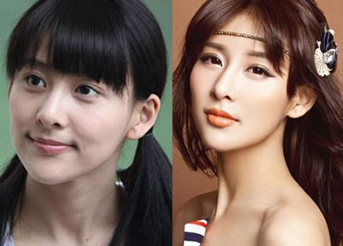 贾青整容前后(贾青没整容之前)