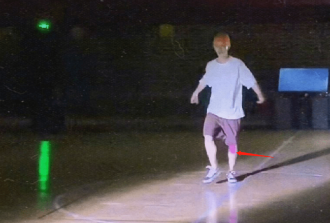 鹿晗现身医院做康复治疗 巡演连轴转旧伤复发?