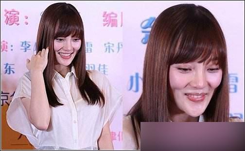 王贝整容失败的原因(被整容坑苦的五位女星)(8)