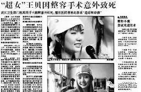 王贝整容失败的原因(被整容坑苦的五位女星)(10)