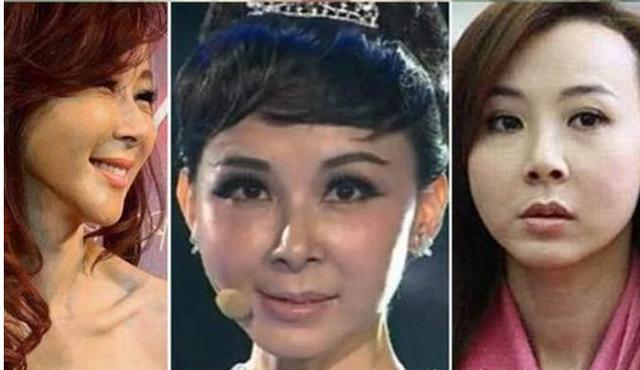 王贝整容失败的原因(被整容坑苦的五位女星)(3)