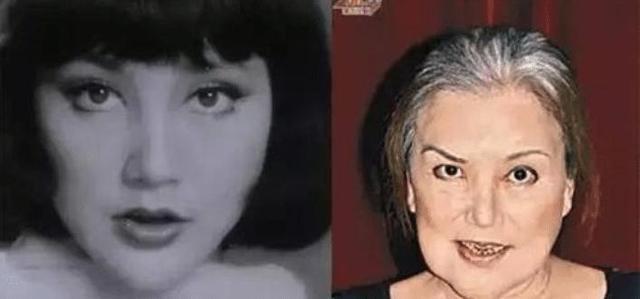 王贝整容失败的原因(被整容坑苦的五位女星)(12)