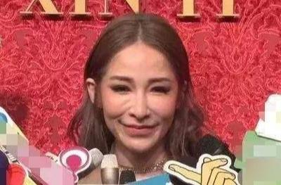 王贝整容失败的原因(被整容坑苦的五位女星)(6)