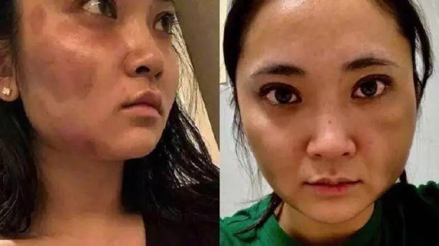 蒋劲夫家暴的来龙去脉(恋爱中发生的暴力)(3)