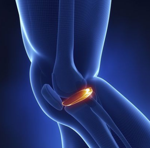 广州女孩患骨膜增生厚皮症,面部褶皱如古稀老翁(染色体显性遗传)