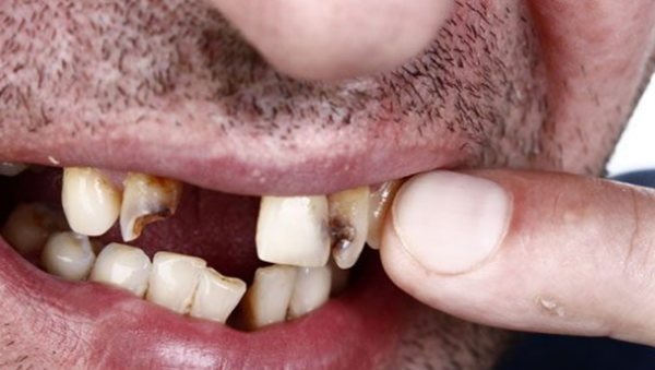 梦睹惧怕的梦被吓醒了?你该当领会的10个罕睹的恶梦含意