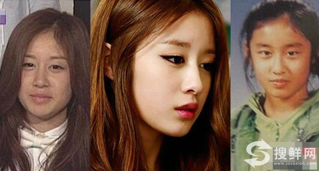 朴智妍整容了吗 朴智妍整容前后照片对比差别大