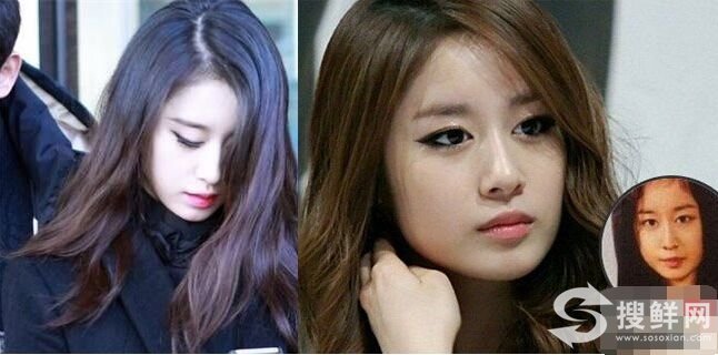 朴智妍整容了吗 朴智妍整容前后照片对比差别大