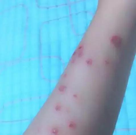 猫癣的症状和防治方法(猫病百科猫癣是啥)(4)