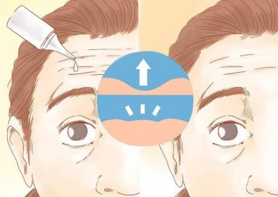 ​怎样消除抬头纹（这四种方法值得一试）