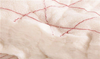 ​被罩上的棉花怎样清算 不妨用胶戴大概者把戏贴去除