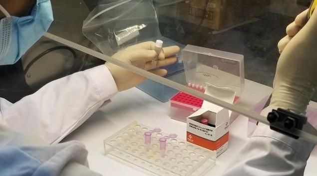 做核酸检测痛苦吗,去医院耳鼻喉科需要核酸检测吗?图5