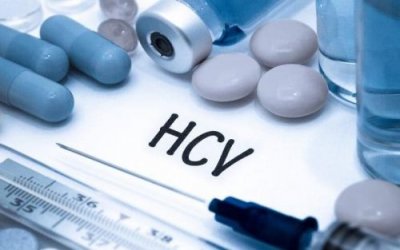 什么是丙肝活动期