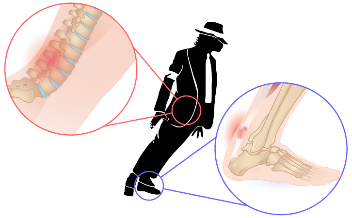 迈克尔·杰克逊 45 度前倾是怎么做到的?