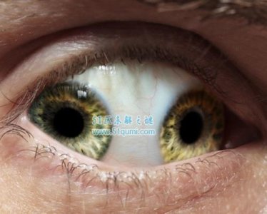 ​中国双瞳孔的人有谁?双瞳孔的人能看到什么?