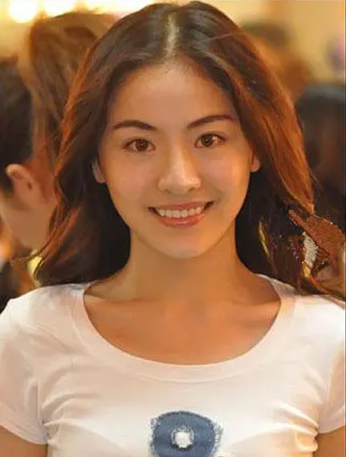 神似张柏芝的贡米跑去整容了!曾经的神颜如今模样大变,让人唏嘘