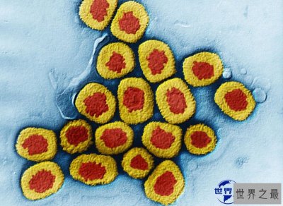 ​导致上亿人死亡的世界十大恐怖病毒，您了解几种？