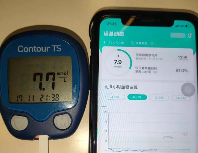 【硅基动感】国产CGM评测,糖友体验怎么样?-