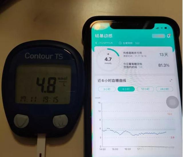 【硅基动感】国产CGM评测,糖友体验怎么样?-