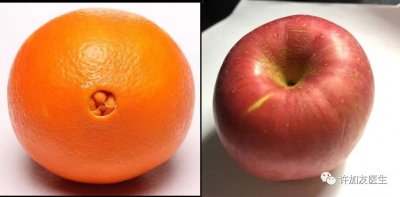 肚脐眼流水 肚脐眼儿流水是因为通着肠子?