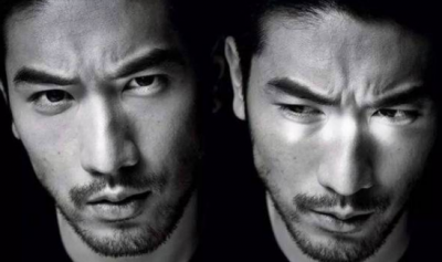 胡须移植 如何一秒变硬汉-胡须种植!