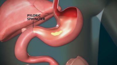 肠胃不好吃什么水果养胃最好(胃肠功能较差的人,4种水果“雨露均沾”,或对