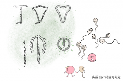 宫内节育器 选择合适的宫内节育器类型,不仅避孕还能治病