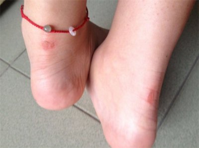 后跟磨脚的小妙招 拯救鞋子磨脚 分分钟做回女神