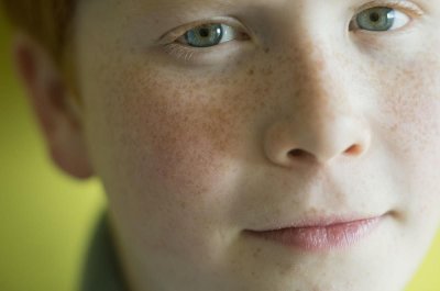 全脸都是斑怎么办?可从这4点入手,斑点逐渐减少