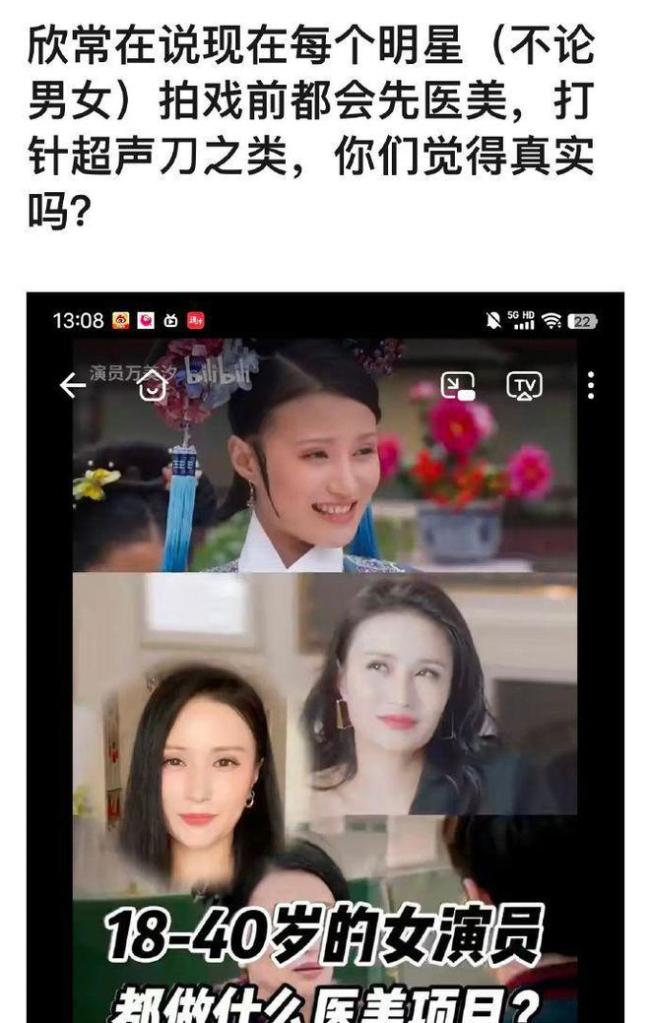 《甄嬛传》女星扯下明星遮羞布!曝拍戏前都去医美