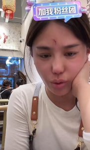 千万网红樊小慧被封号!自曝被婆婆殴打,网友发现3点疑点
