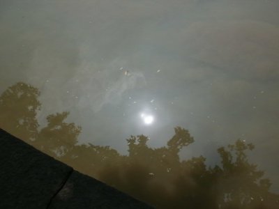 津渊美智子查出布查氏综合症,布查氏综合症