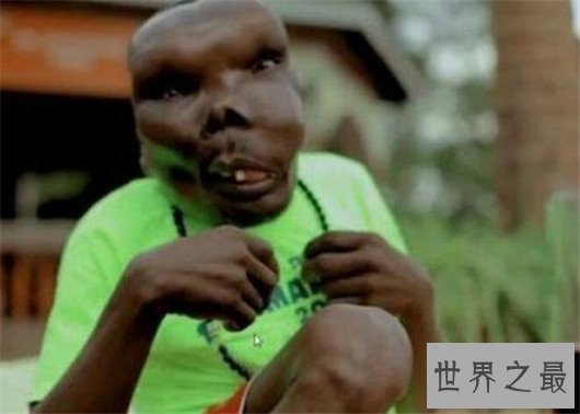 最丑男人丑陋外表无法想象，参加选秀节目成冠军