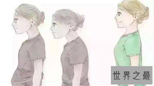 含胸是什么意思 怎么改善不良含胸驼背习惯