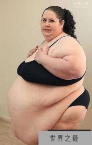 ​全球最胖的女人，苏珊娜·埃曼和罗莎莉·布拉德福德(两人重达253