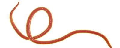 ​铁线虫到底是什么 什么叫铁线虫