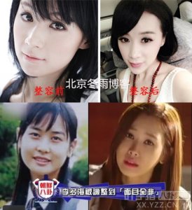 女星姚芊羽整容变残 韩女星李多海再度变脸