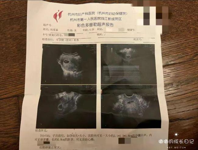 72岁张纪中再当爸!张纪中42岁妻子已怀孕50天