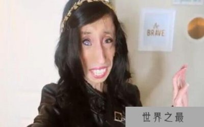 ​世界上最丑的人唐全书，因丑获得世界吉尼斯记录（五官极其吓人）