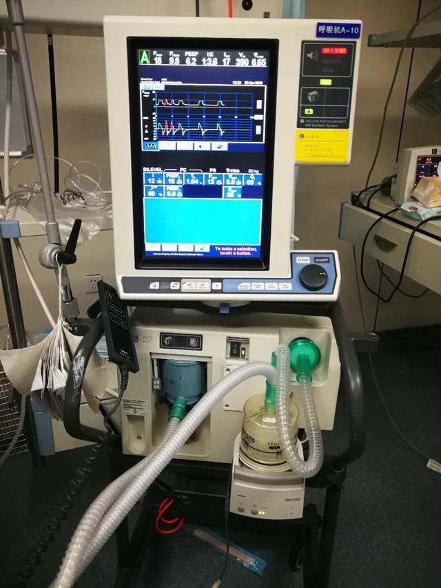 ICU中的呼吸机到底多贵,真是每天费用过万吗?重症医生说实话了-