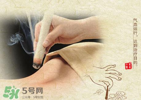 三伏灸和艾灸的区别_三伏灸是艾灸吗 三伏灸和艾灸的区别_三伏灸是艾灸吗