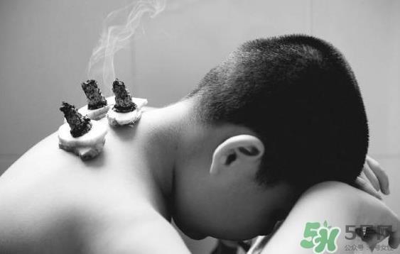 三伏灸要灸几次?三伏灸要灸多久? 三伏灸要灸几次?三伏灸要灸多久?