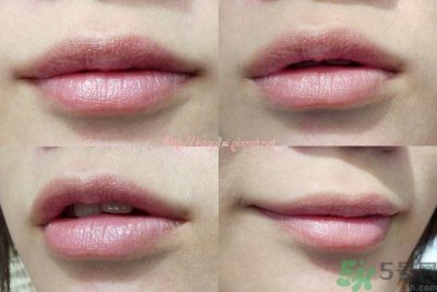 唇色发白是怎么回事?唇色发白怎么办?