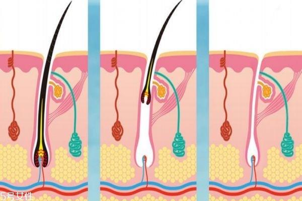 女性吃牛肉会容易长胡子吗 女性吃什么容易长胡子 女性吃牛肉会容易长胡子吗 女性吃什么容易长胡子
