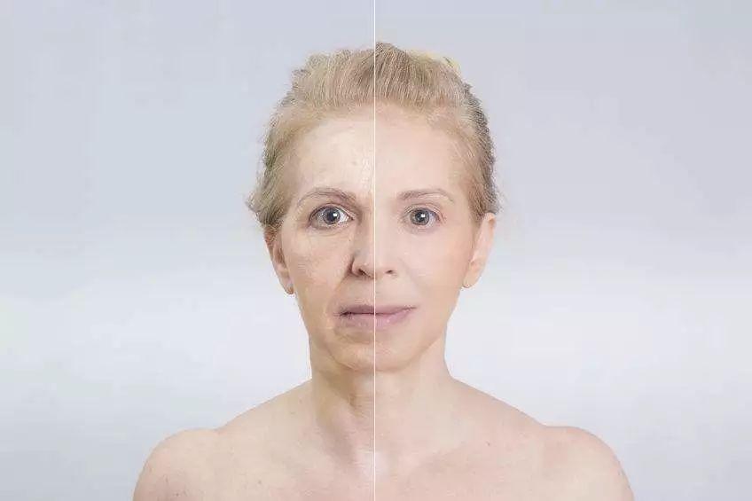 抗皱纹的方法 抗皱纹的食物有哪些 抗皱纹的方法 抗皱纹的食物有哪些