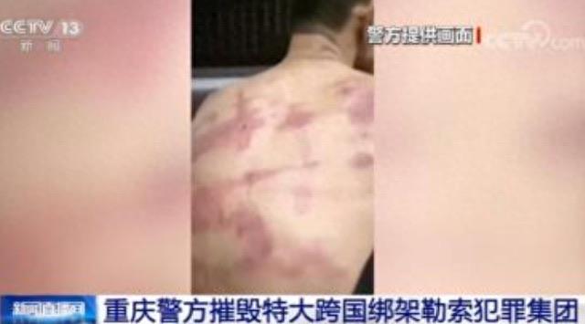 探秘如果大量美国人被割了腰子，缅北会是什么下场？很过瘾但也很危险  3