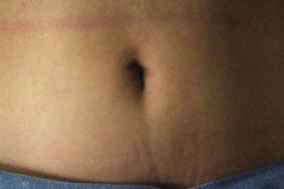 ​肚脐眼里的泥太多，还发臭，能抠吗？3个清理方法，还你干净肚脐