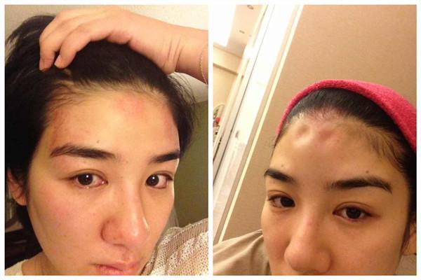 盘点被男人家暴打得伤痕累累的十大女星，强烈谴责家庭暴力